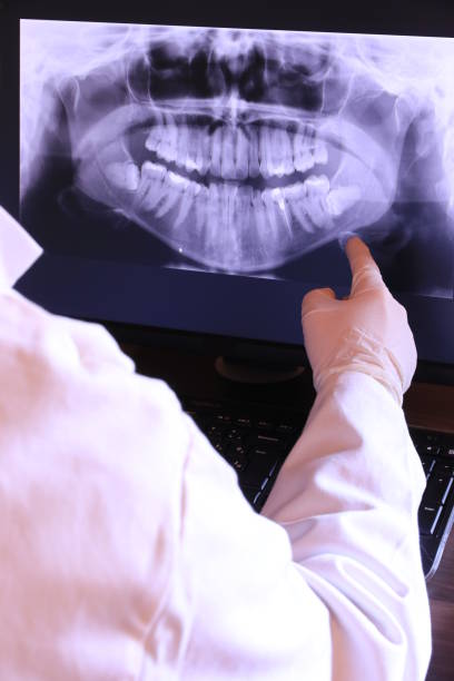 Best Emergency Root Canal Treatment in Pinehurst, NC