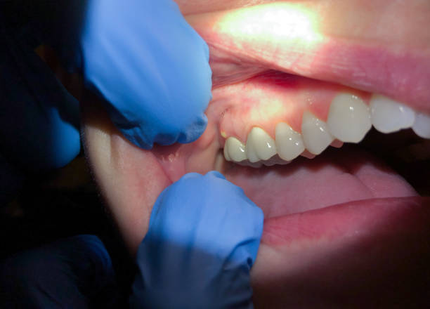 Best Emergency Dentist for Special Needs Patients in Pinehurst, NC