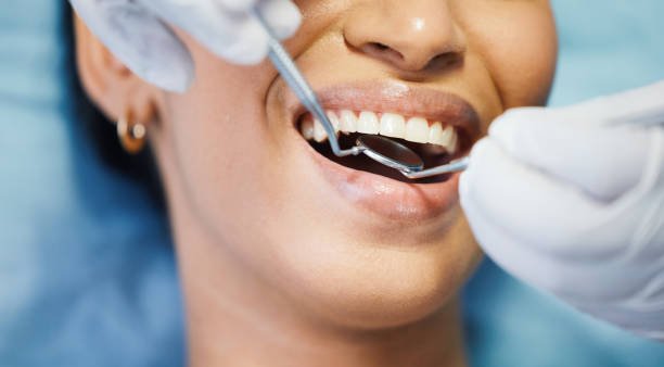 Best Broken or Cracked Tooth Emergency Dentist in Pinehurst, NC
