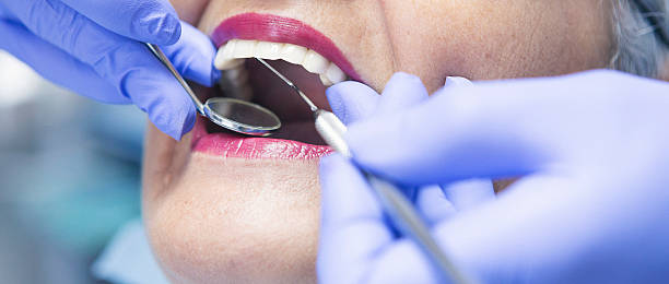 Best Emergency Dentist for Knocked-Out Tooth in Pinehurst, NC